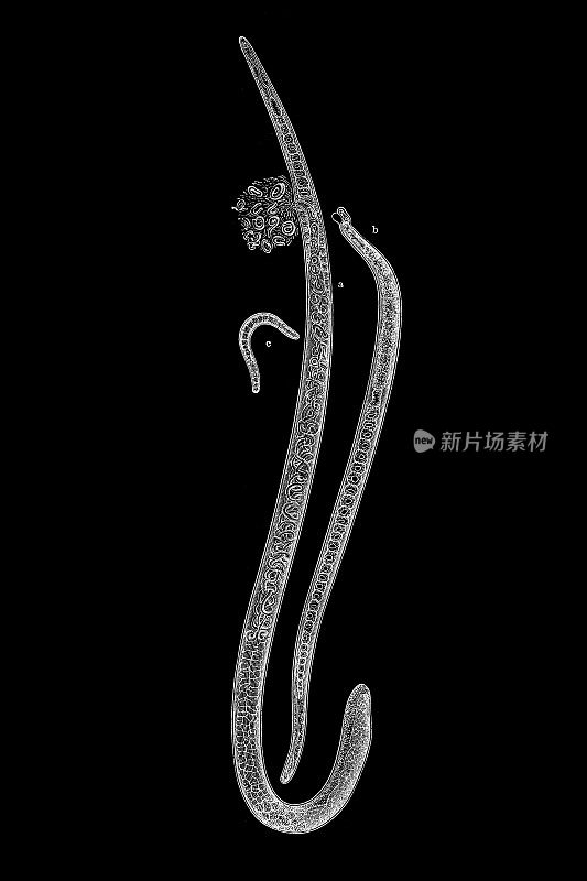 三毛虫(tricina spiralis，或Trichinella spiralis)，雌(a)，雄(b)胚胎(c)